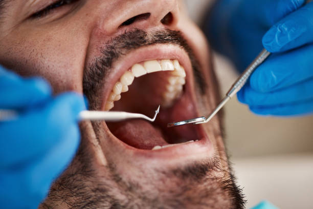 Best Same-Day Emergency Dental Services in Cienegas Terrace, TX