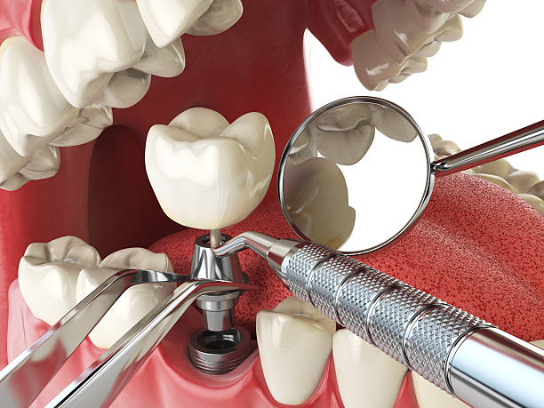 Best Emergency Denture Repair in Cienegas Terrace, TX